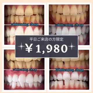 ホワイトニングショップ時津店所属・ホワイトニング ショップ長崎時津店のその他イメージ