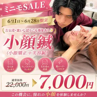 【美容鍼・小顔鍼】 鍼灸師　森原拓磨のエステ・リラクイメージ