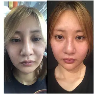 aliaハーブ水光店 エステティシャン募集のエステ・リラクイメージ