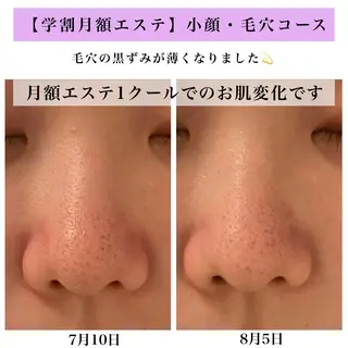 Bellesthe (ベルエステ)のエステ・リラクイメージ
