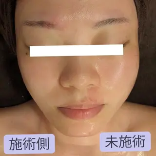 小顔矯正コルギ専門 ボディーワークスナビのエステ・リラクイメージ