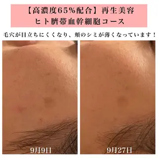 Bellesthe (ベルエステ)のエステ・リラクイメージ