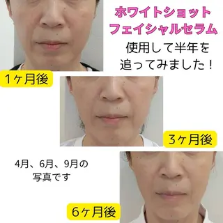 POLA The Beauty印場店のエステ・リラクイメージ