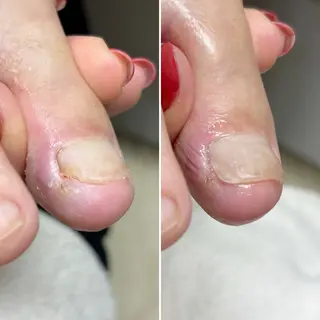 ネイル 深爪・巻き爪 専門サンセリテのネイルデザイン