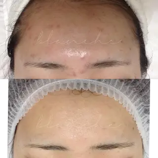 セミロング カラー パーマ ヘアアレンジ ネイル マツエク・マツパ アイブロウ 都度払い肌質改善 &脱毛Blancheのエステ・リラクイメージ