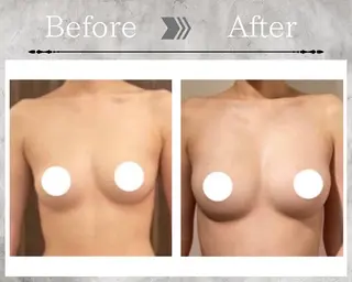 Feliz(ユーカリレンタルサロン内)所属・【バストケアサロン】 Feliz フェリスのエステ・リラクイメージ