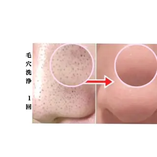 肌ケア＆毛穴洗浄 Cheri/女性専用のエステ・リラクイメージ