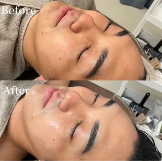 LTIENA新宿🌷 maiのエステ・リラクイメージ