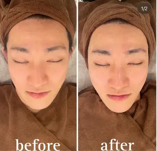 小顔・リフトアップ/ 奈緒美のエステ・リラクイメージ