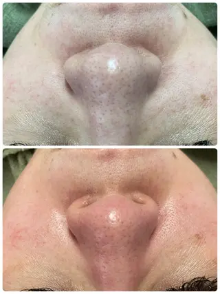 🔰 新米ネイリストのネイルデザイン