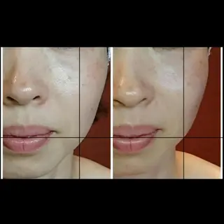 Nako  ﾅｺのエステ・リラクイメージ