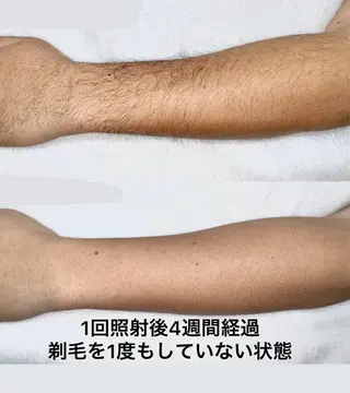 【本格脱毛】 グレイスフルルームのエステ・リラクイメージ