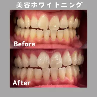 Kaula ホワイトニング🦷✨のエステ・リラクイメージ