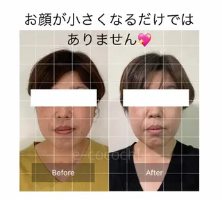 小顔と ヘッドスパのお店のエステ・リラクイメージ