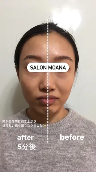 小顔美肌salon MOANAのエステ・リラクイメージ