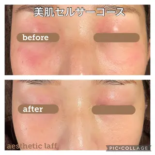 美肌作りのサロン 山村亜美のエステ・リラクイメージ