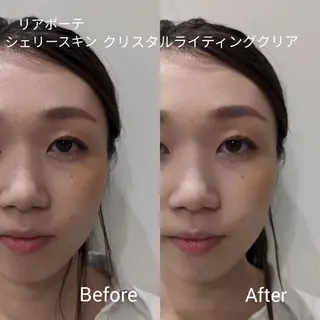 ﾌｪｲｼｬﾙｴｽﾃ ﾗﾄｩｰﾙ伊深のエステ・リラクイメージ