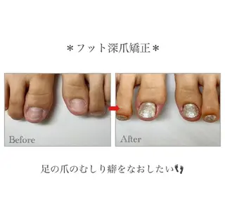 ネイル ネイルサロン アリュームのネイルデザイン