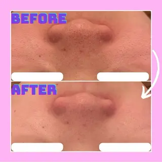 Lily luce 美骨小顔矯正のその他イメージ