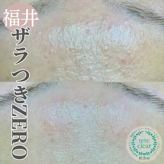 毛穴肌質ケアサロン Yourmeユアミーのエステ・リラクイメージ