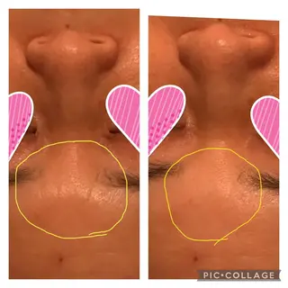 POLA 大阪堀江店のエステ・リラクイメージ