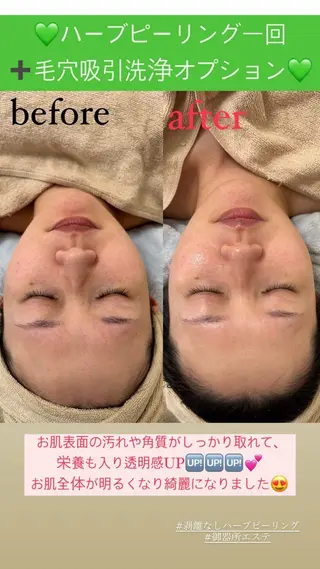 メンズ Salon de Lino 御器所のエステ・リラクイメージ