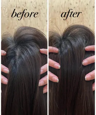 個室ドライヘッドスパ 🍃moriのエステ・リラクイメージ