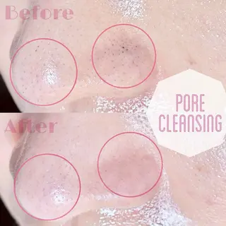 eye  salon Bonnyのマツエク・マツパデザイン