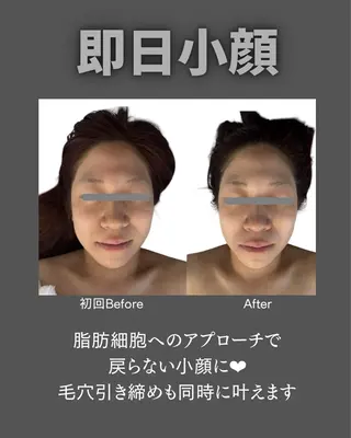 BLOSSOM 菊地のエステ・リラクイメージ