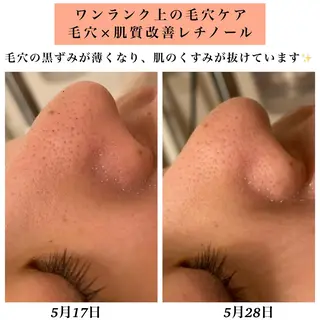 Bellesthe (ベルエステ)のエステ・リラクイメージ