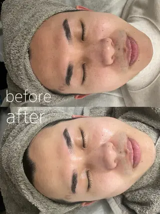 LBSホワイトニング 🌐岡山店のその他イメージ