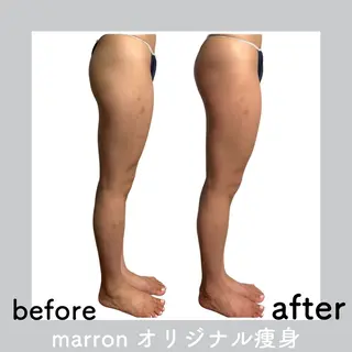 marron所属・痩身ハイパーナイフ ララピールリアボーテのエステ・リラクイメージ