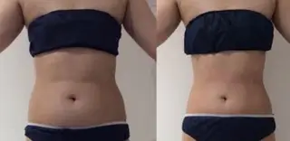 メンズ beauty salonnのエステ・リラクイメージ