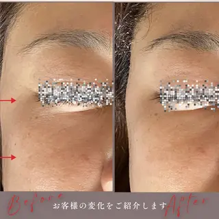 LUMINAルミナ 【肌管理サロン】のその他イメージ
