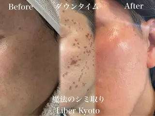 Liber CHIKAのエステ・リラクイメージ