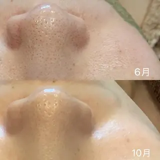 Adiy ikumiのエステ・リラクイメージ