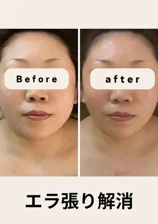 本格小顔コルギサロン ミピマムマールのエステ・リラクイメージ