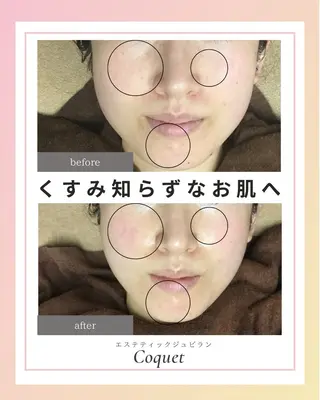 エステティックジュビランCoquet所属・ジュビラン Coquetスタッフのエステ・リラクイメージ