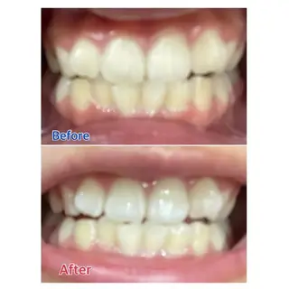 M渋谷 ホワイトニングのエステ・リラクイメージ