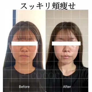 小顔と ヘッドスパのお店のエステ・リラクイメージ