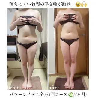 《本気痩せ×疲労改善 》  BILOOPのエステ・リラクイメージ