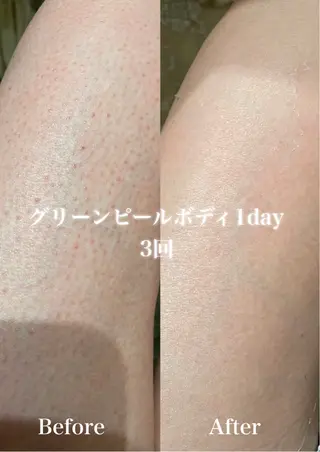 グリーンピール専門店 サロンY【大阪】のエステ・リラクイメージ