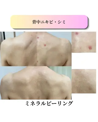 ローズフィールド 森岡朋美のエステ・リラクイメージ