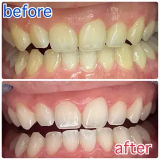 サクッとホワイト五反田店所属・セルフホワイトニング 五反田のその他イメージ