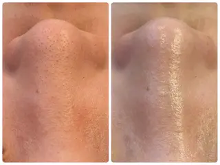 Hisui 小出のエステ・リラクイメージ