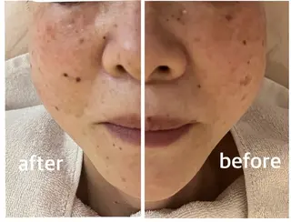 Alluring アルーリング中村のエステ・リラクイメージ