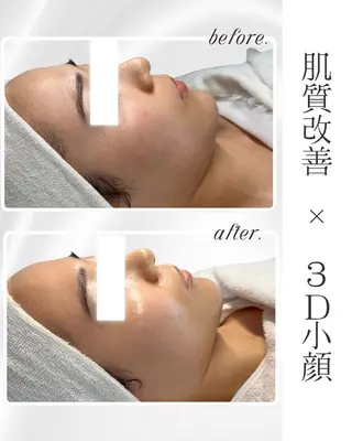 LiAm《美肌管理/ 小顔/脂肪ケア》のその他イメージ