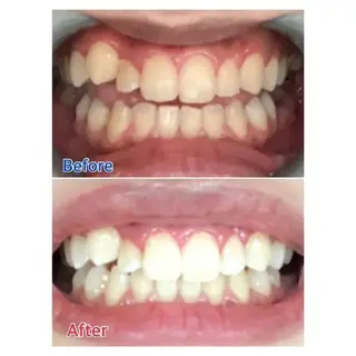 M渋谷 ホワイトニングのエステ・リラクイメージ