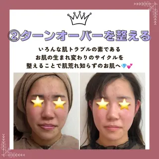 Prima 〜プリマ栄店〜のエステ・リラクイメージ
