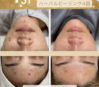 アロマ&アーユルヴェーダサロンParadiso横浜所属・冨菜 みらいのエステ・リラクイメージ